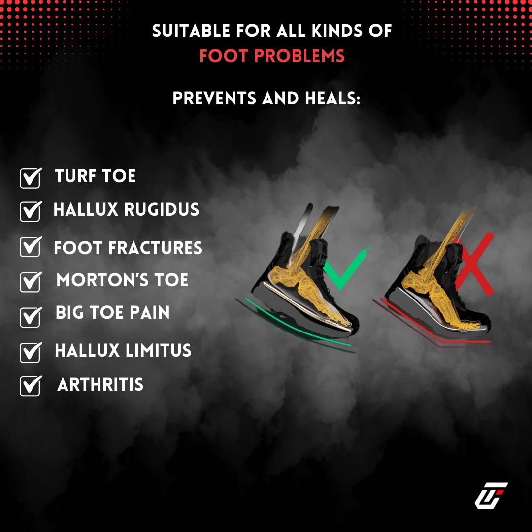 Premium Carbon Fiber Insoles - Ultra Feet Labs
